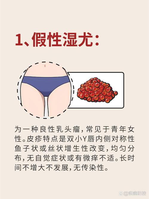 下面长小疙瘩是怎么回事