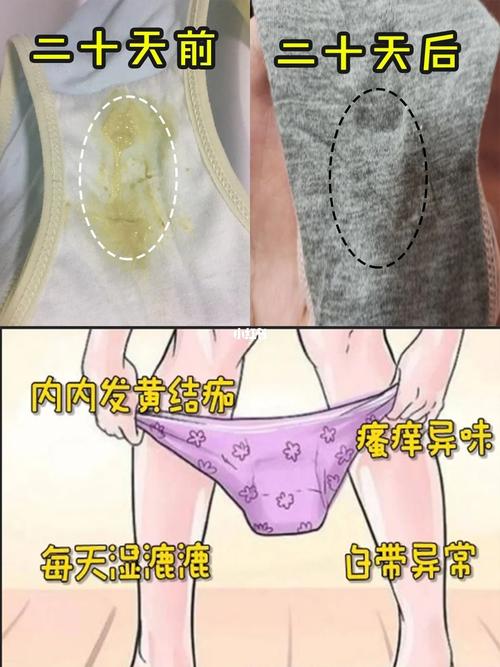 内裤弄成一条线摩擦会怎么样
