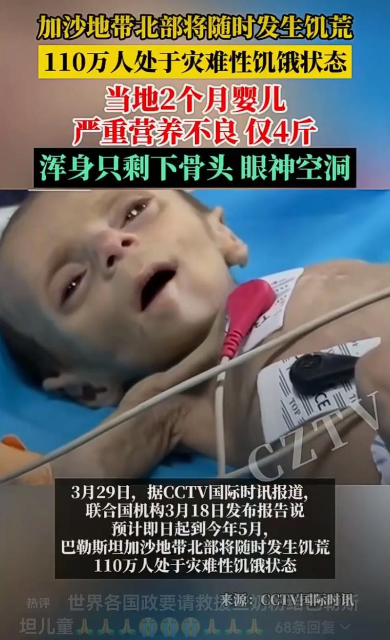 饥饿的阿 需要灭火
